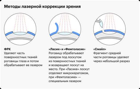 Репутация клиники и стоимость лазерной коррекции зрения