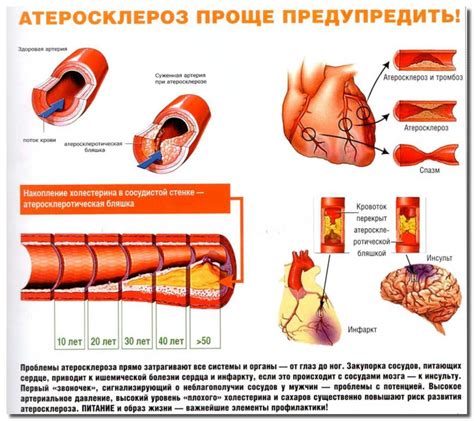 Роль атеросклероза в организме