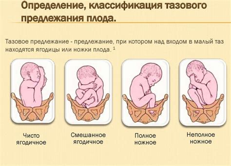 Роль принятия окончательного положения ребенка перед родами