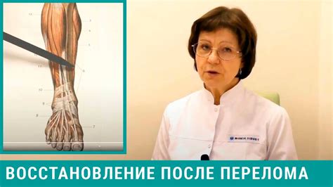 Роль реабилитации в восстановлении функций ноги лошади после перелома
