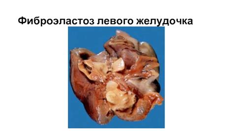 Сало и кардиоваскулярная система