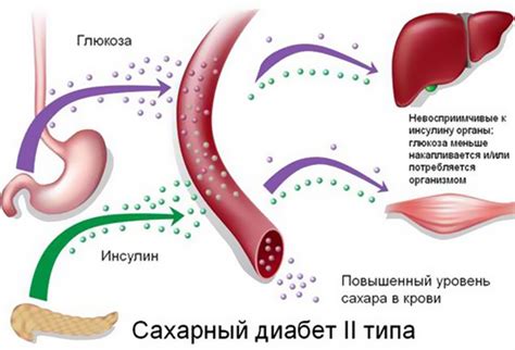 Сахарный диабет и его проблемы