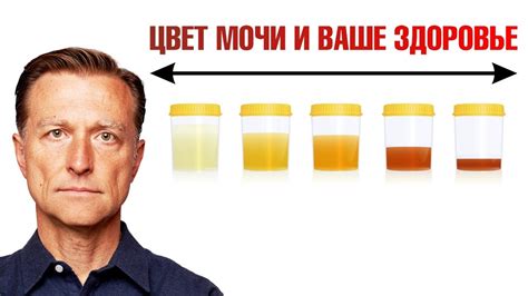 Свекла - основная причина красного цвета мочи у детей