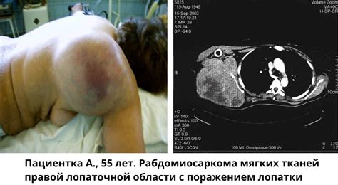 Связь, факты и возможности лечения