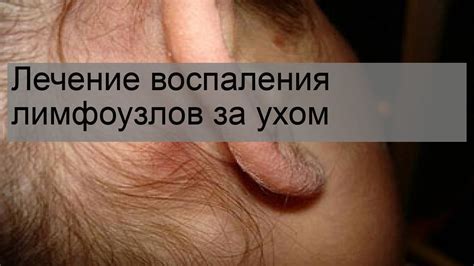 Связь воспаления лимфоузла с отитом