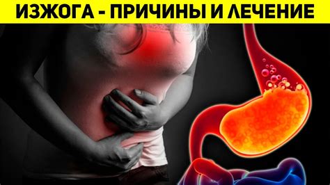 Связь изжоги и рвоты: причины и лечение
