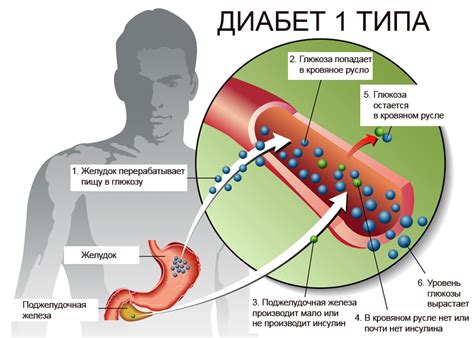 Связь между сахарным диабетом и аппетитом