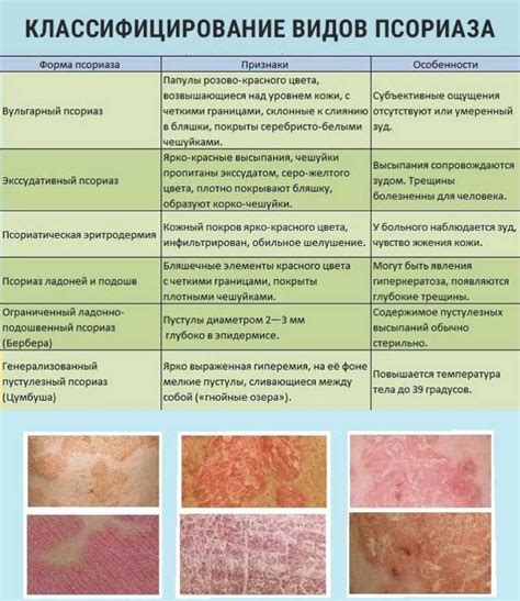 Симптомы, высыпания, особенности