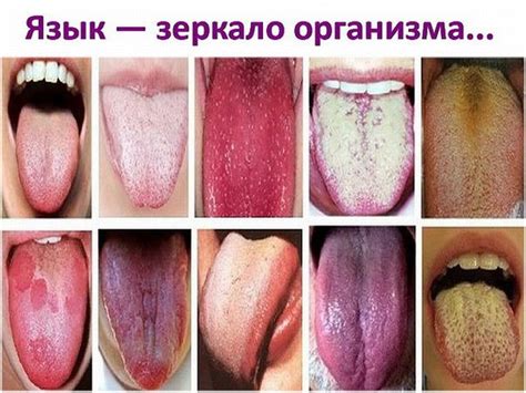 Симптомы, причины и последствия прокола языка