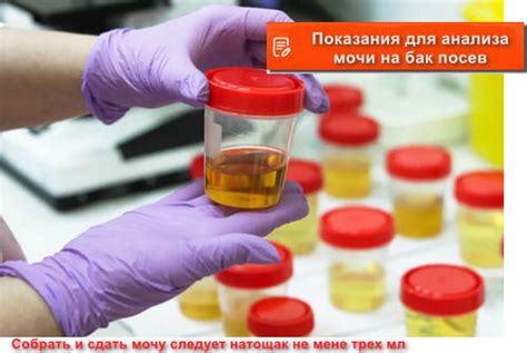 Симптомы, при которых следует сдать мочу на бак посев