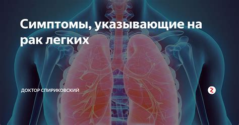 Симптомы, указывающие на необходимость КТ легких