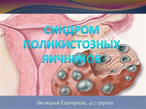 Симптомы избыточной эндометрии