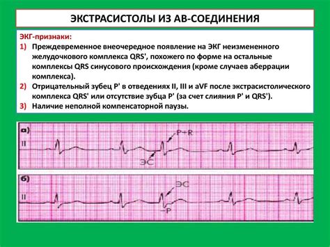 Симптомы наджелудочковой экстрасистолии