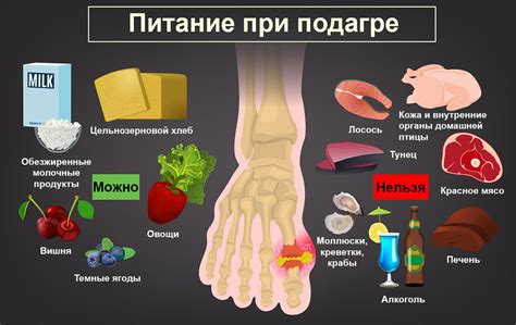Симптомы подагры