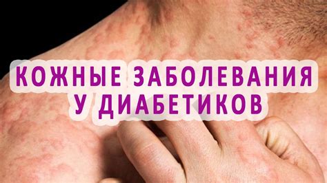 Симптомы чесания кожи от сухости