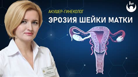 Симптомы эрозии после родов: как распознать проблему