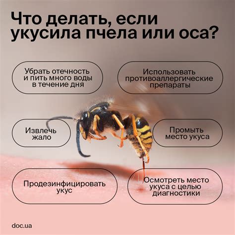 Синафлан от укуса осы: облегчение симптомов и быстрое восстановление