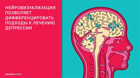 Систематизация депрессии