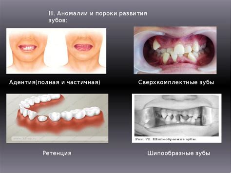 Скелетные аномалии челюстно-лицевой области