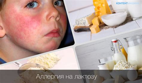 Следует отказаться, если у вас есть аллергия