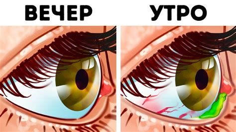 Смешение цветов глаз во сне