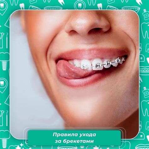 Советы для достижения прекрасной улыбки