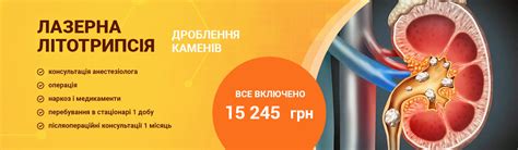 Современные способы лечения камней в почках