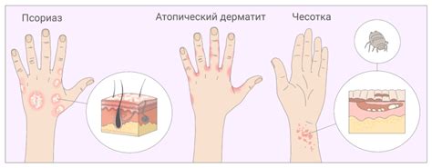 Солнце и кожный зуд: их взаимосвязь и профилактика