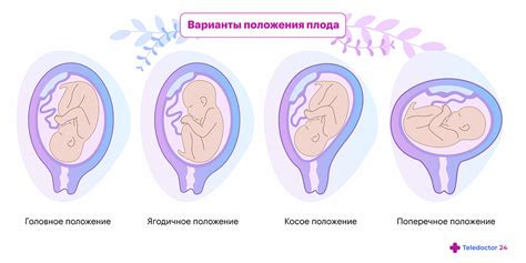 Способы изучения реакции плода на свет