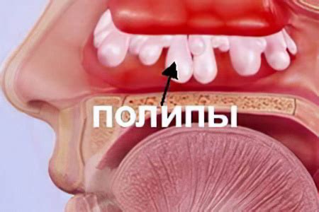 Способы компенсации отсутствия обоняния