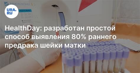 Способы обнаружить передачу мочи