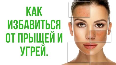 Способы предотвращения прыщей от воды и советы по уходу за кожей