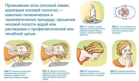 Способы проведения промывания