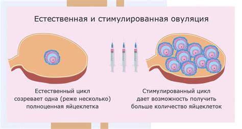 Способы стимуляции овуляции
