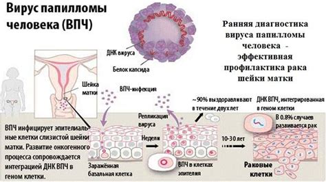 Существующие методы изменения типа ВПЧ