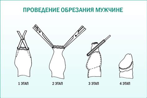 Техника безопасного обрезания