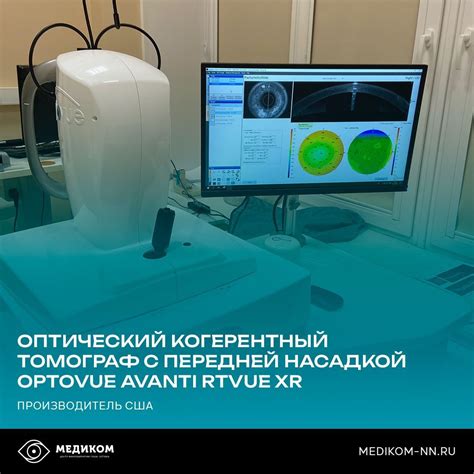 Технологии, влияющие на стоимость лазерной коррекции зрения