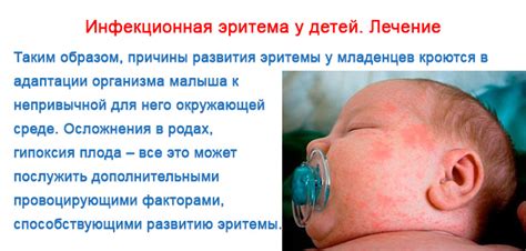 Токсическая эритема у новорожденных: причины и диагностика