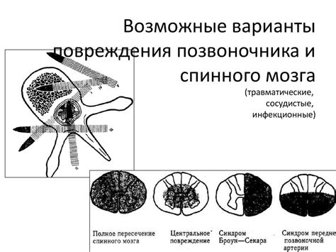 Травматические спорышки