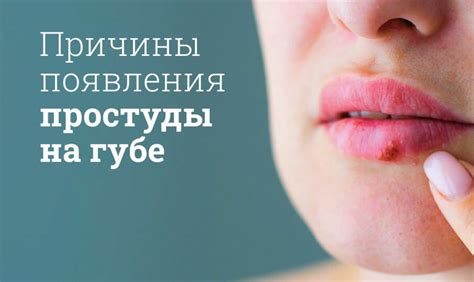 Традиционные методы лечения простуды на губе