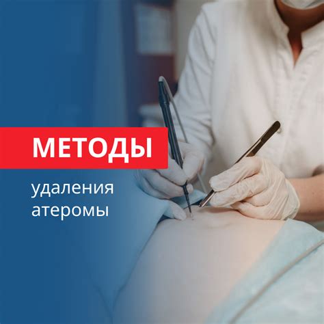 Традиционные методы удаления атеромы