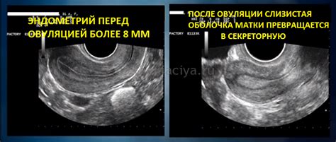 Указатели на готовность яйцеклетки