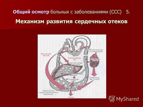 Улучшение кардиоваскулярной системы