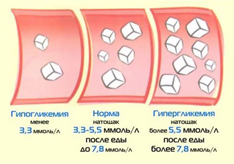 Уровень сахара в крови и его связь с здоровьем
