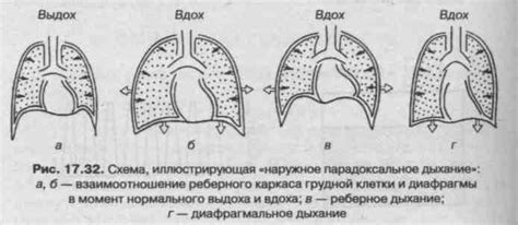 Ухудшение газообмена