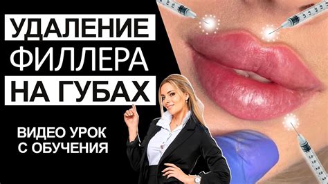 Факторы, влияющие на сохранение эффекта набухания губ после рассасывания филлера