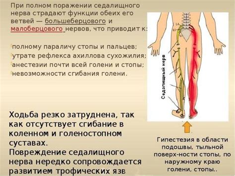 Факторы риска повреждения седалищного нерва при уколах
