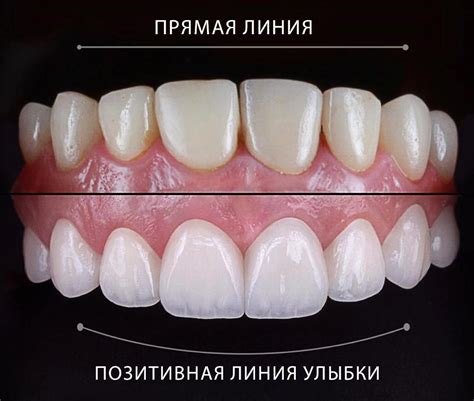 Физиологические преимущества улыбки