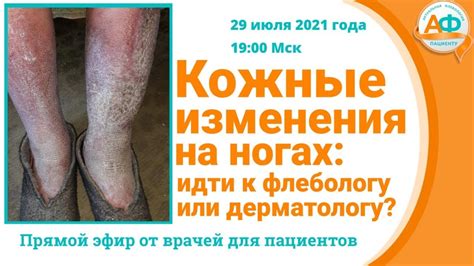 Физические изменения на ногах