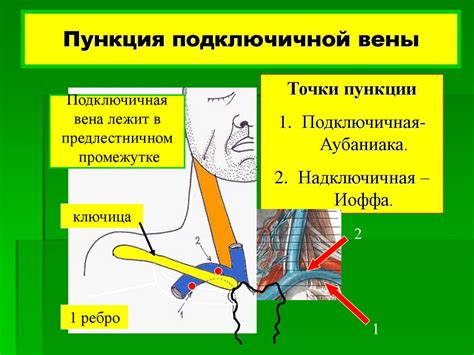 Формирование нервных пучков